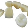 牙科瓷块专用高纯氧化锆